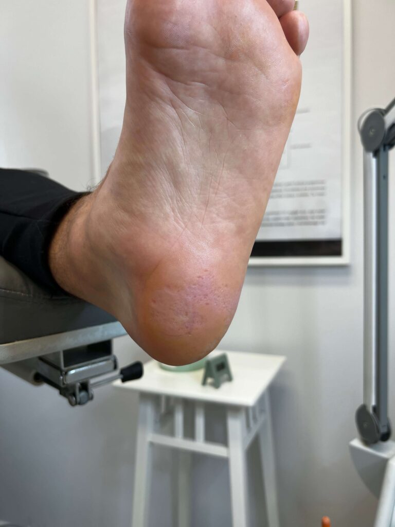 OPRACOWANIE PODESZWY PROBLEMATYCZNEJ PO