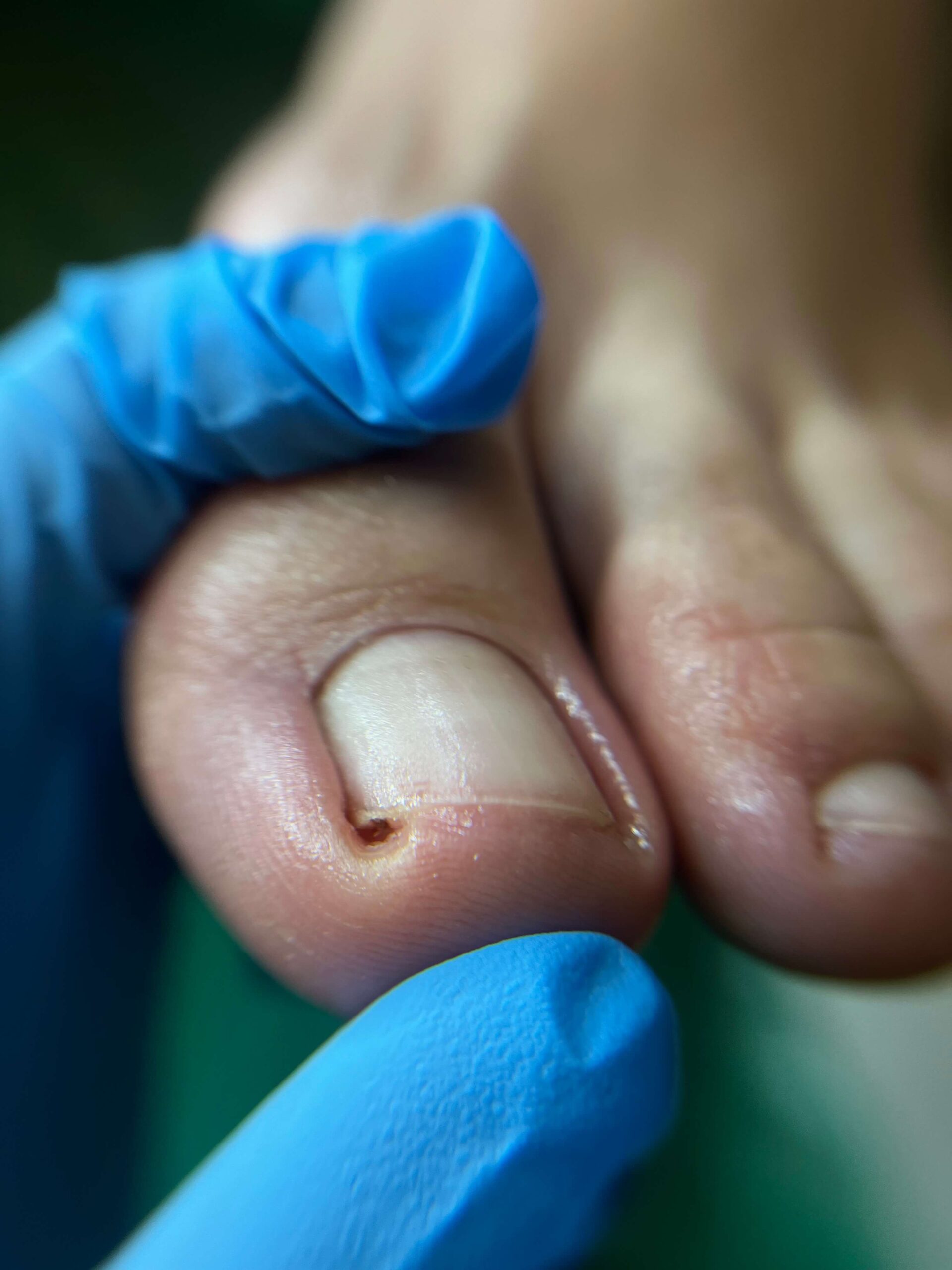 opracowanie paznokci PO scaled