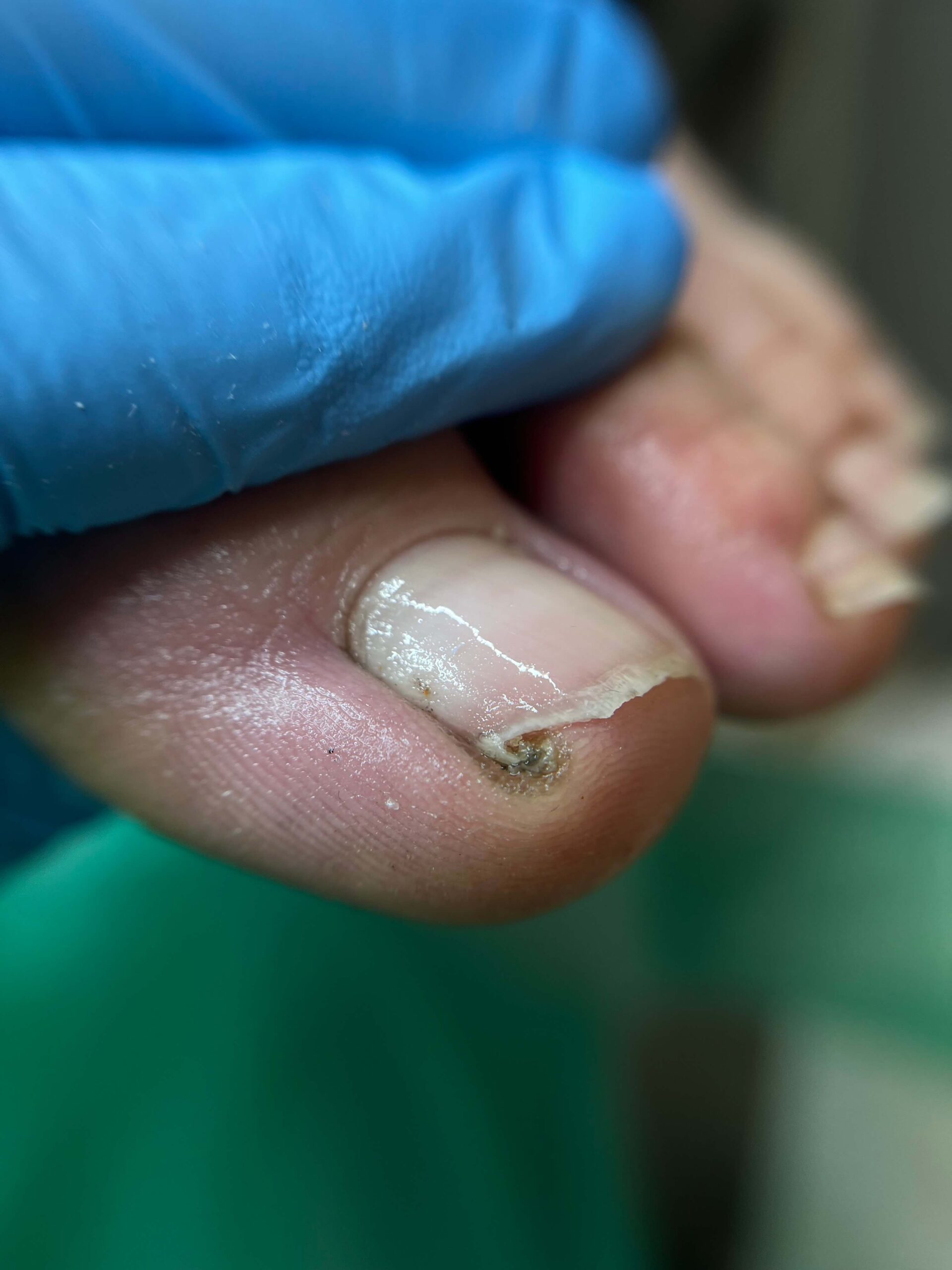 opracowanie paznokci PRZED 2 scaled